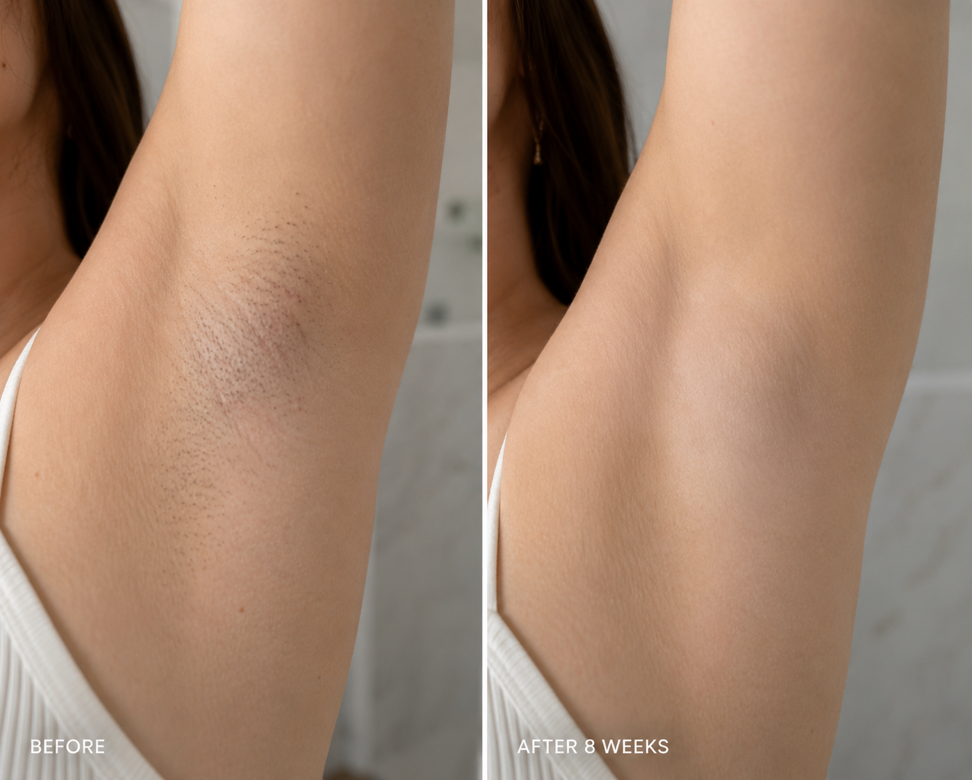 Underarm before use and after 8 weeks, showing smoother skin with less visible regrowth